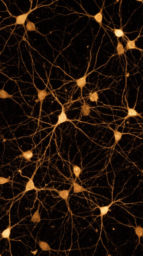 Neuroprotection & Brain Health microscopy