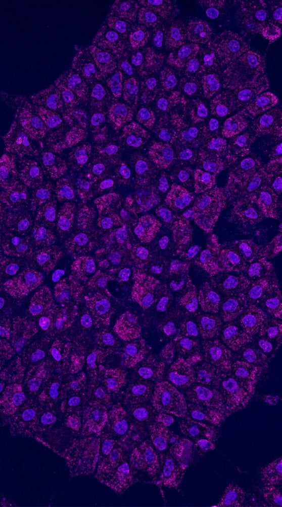 Polyamine Metabolism microscopy