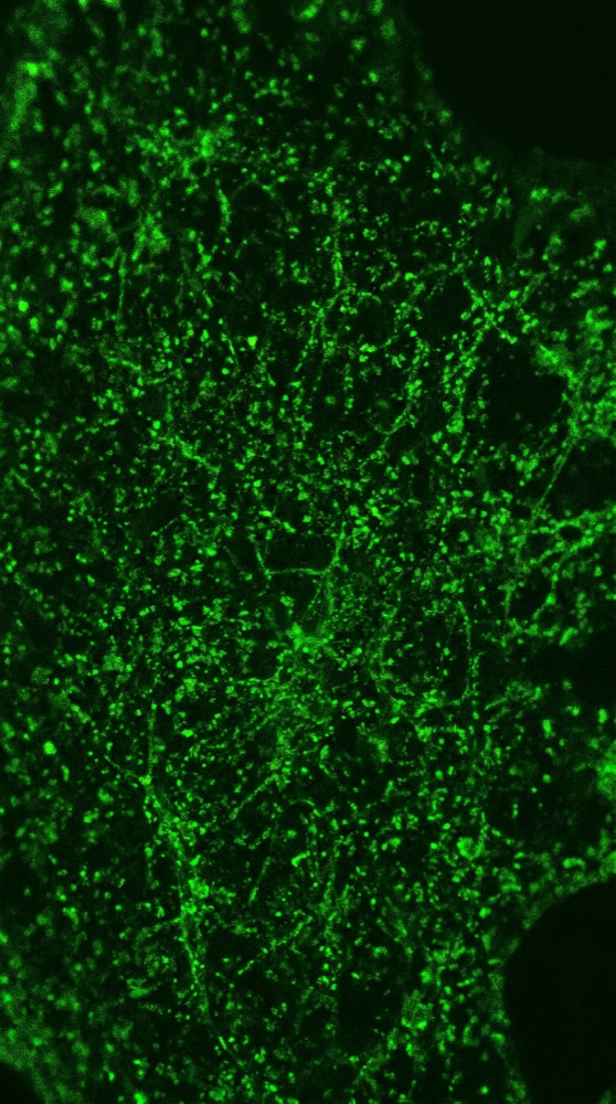 TCA Cycle & Energy Metabolism microscopy